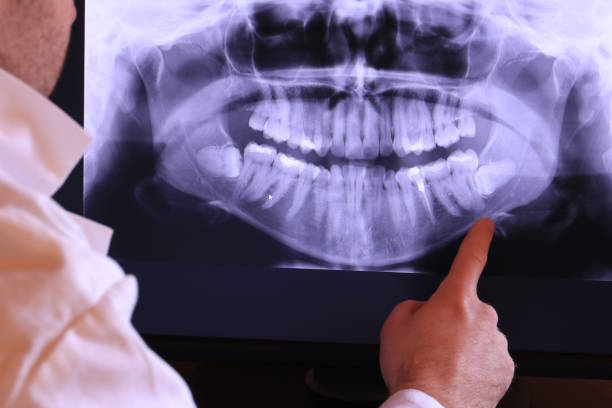 Best Emergency Dental Care for Broken or Chipped Teeth in Sunnyside, CA